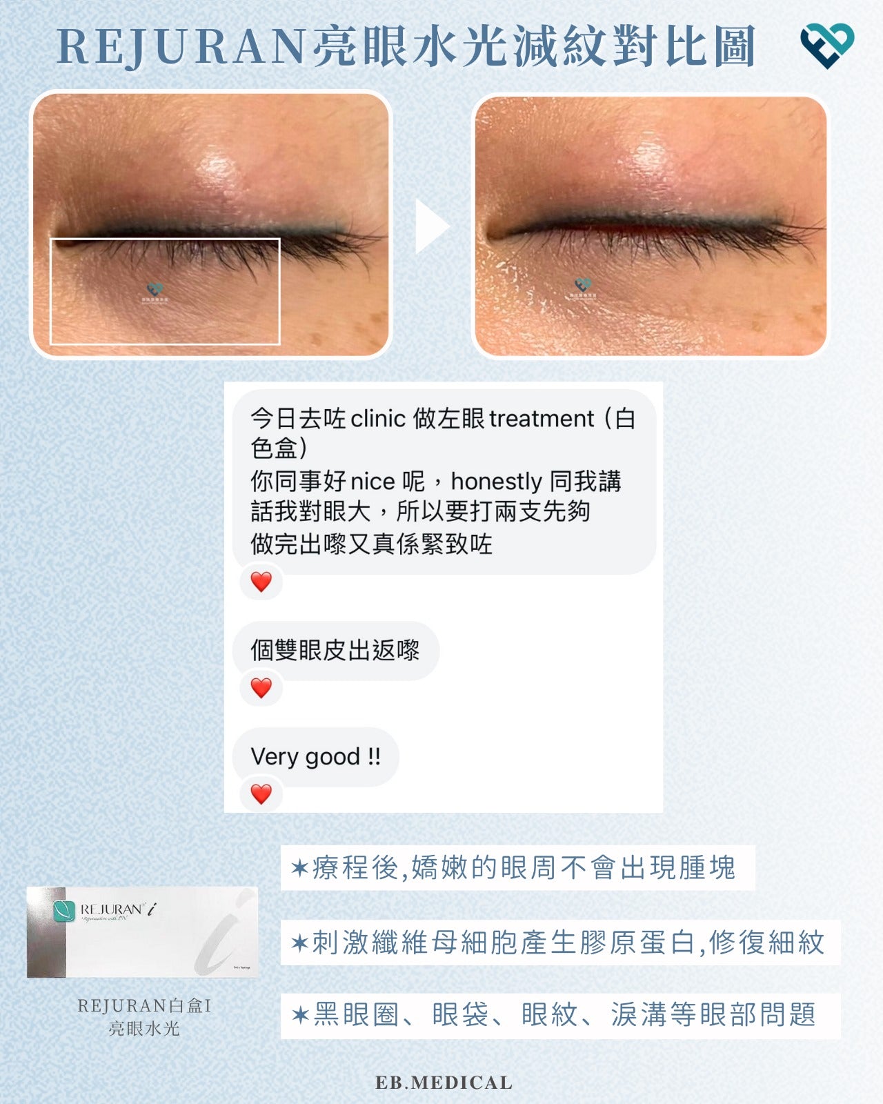 【水光針】REJURAN白盒