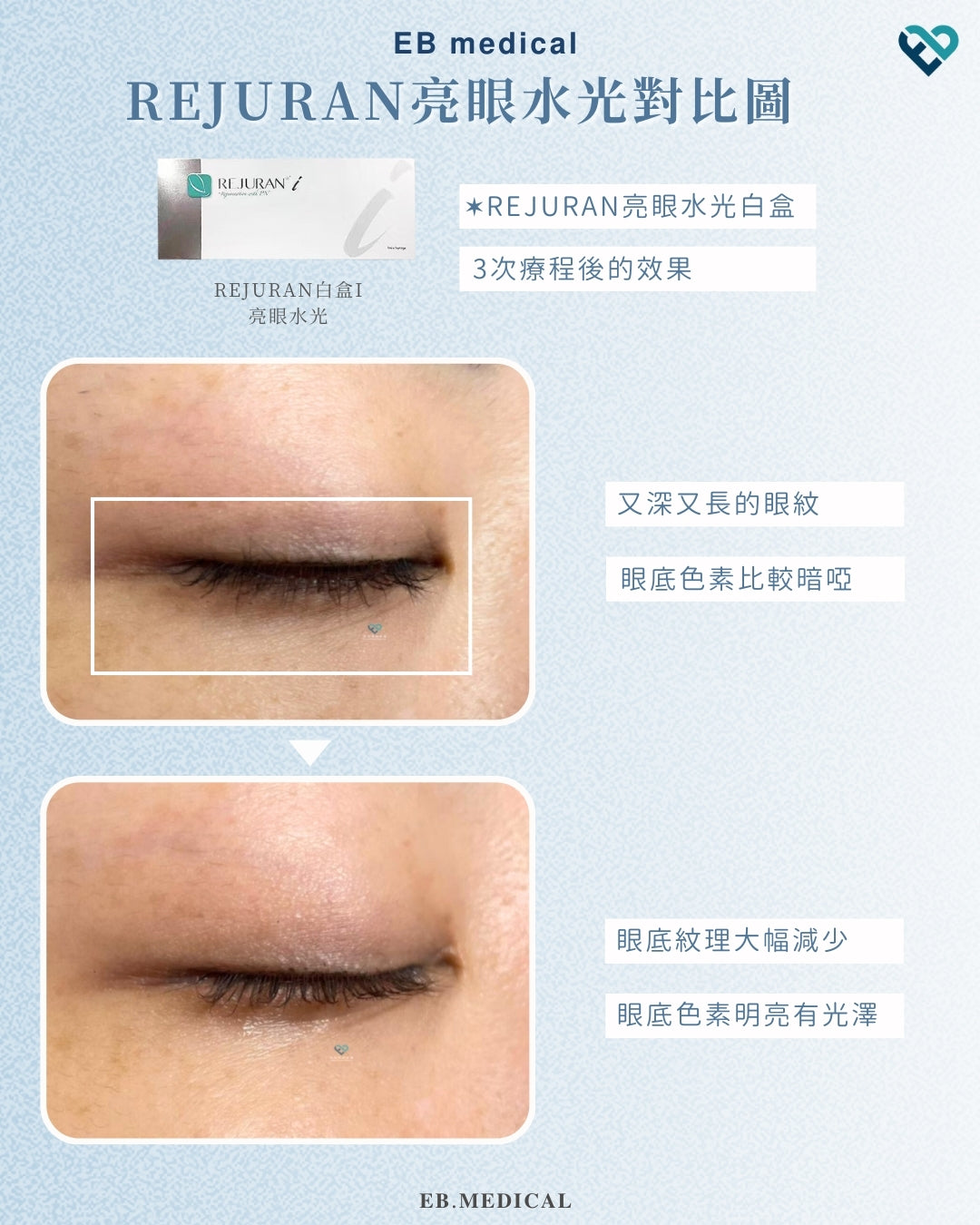 【水光針】REJURAN白盒