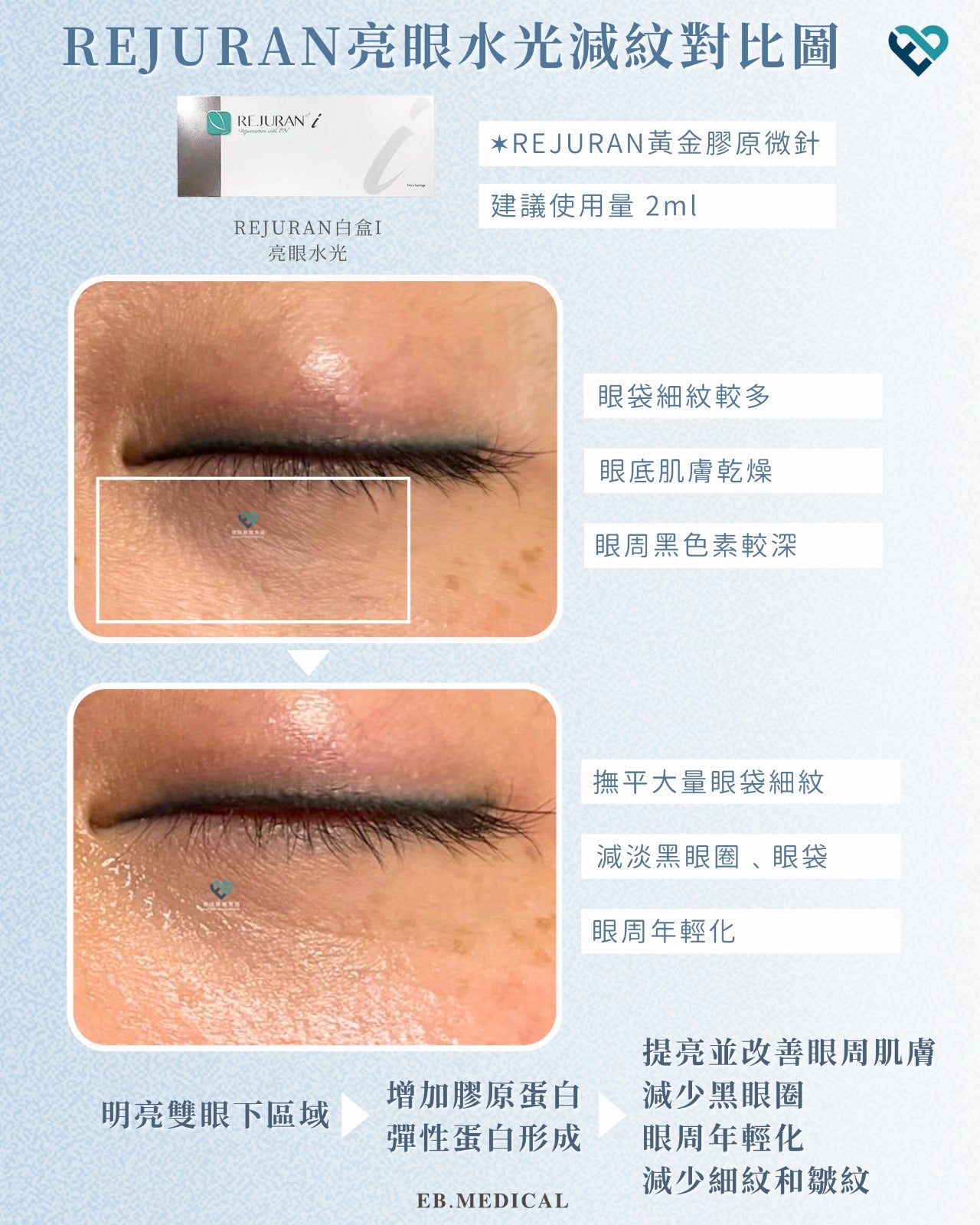 【水光針】REJURAN白盒