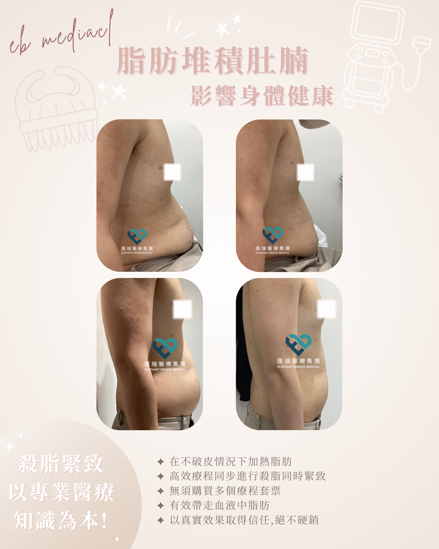 【FDA認證】細胞激活瘦身療程